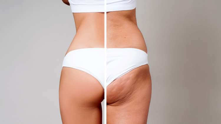 Is Weight Loss Surgery  Safe