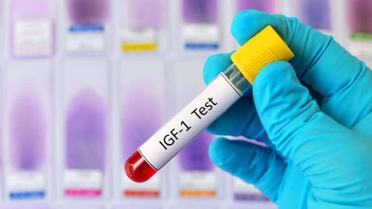 What Is IGF-1