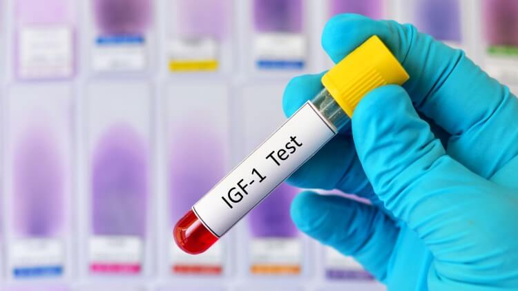 What Is IGF-1 | It’s Benefits, and Possible Side Effects – PhenQ (USA)