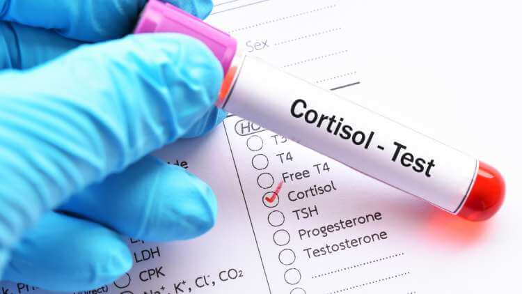 How To Reduce Cortisol Levels Naturally